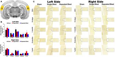 Blast Exposure Causes Long-Term Degeneration of Neuronal Cytoskeletal Elements in the Cochlear Nucleus: A Potential Mechanism for Chronic Auditory Dysfunctions